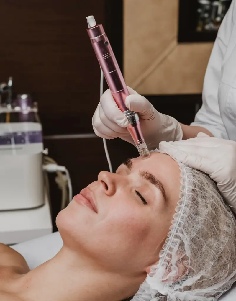 A close-up of a hand holding a pink microneedling device while performing a facial treatment, showcasing sterile gloves and a professional setting.
